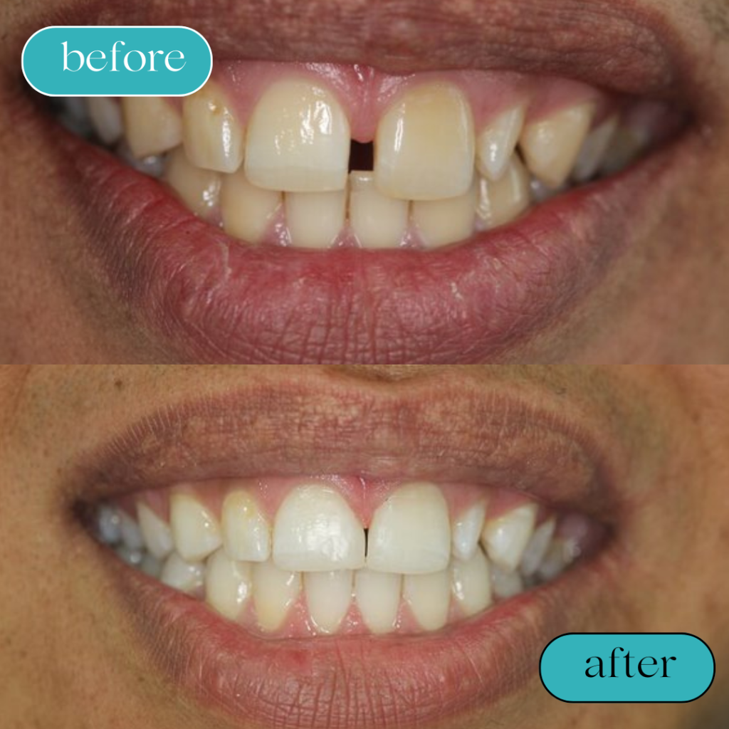 Black White Minimalist Hair Beauty Before After Instagram Post (1)