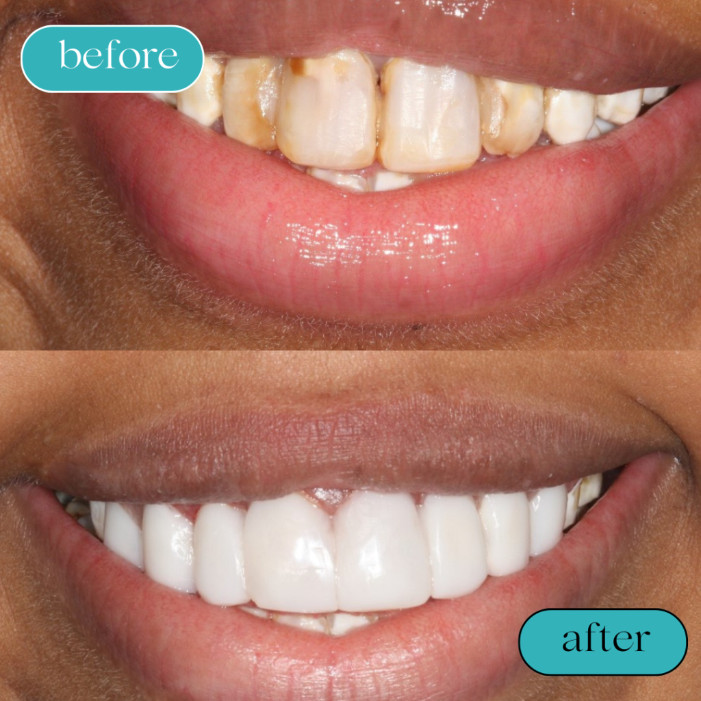 Black White Minimalist Hair Beauty Before After Instagram Post (3)