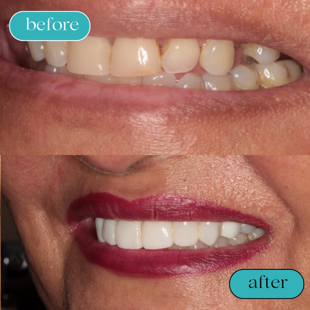 Black White Minimalist Hair Beauty Before After Instagram Post (4)