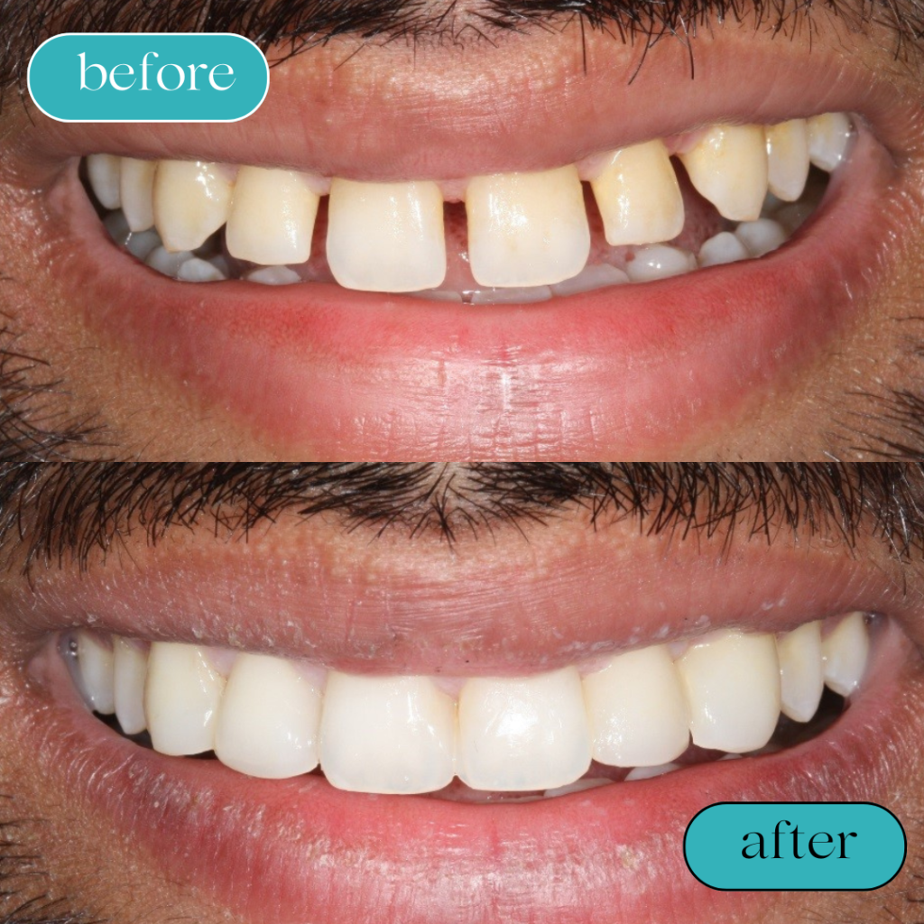 Black White Minimalist Hair Beauty Before After Instagram Post (5)