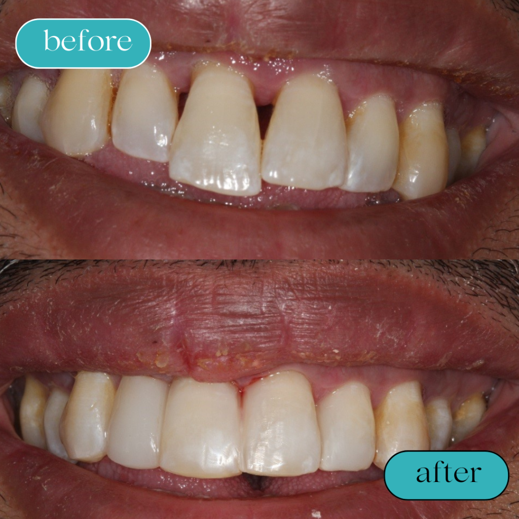 Black White Minimalist Hair Beauty Before After Instagram Post (6)